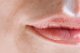 Herpes a opary? CBD olej môže byť odpoveďou, ktorú ste hľadali